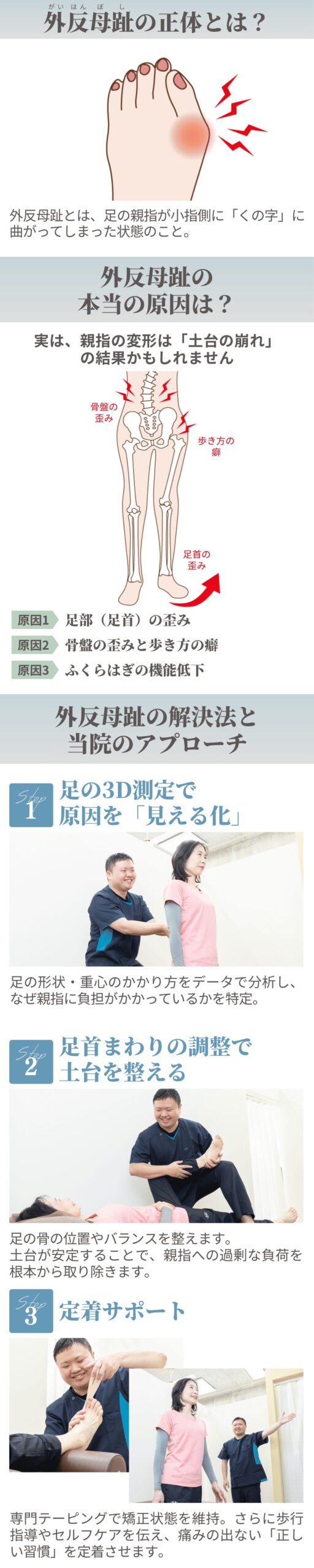 外反母趾の治療コンセプト